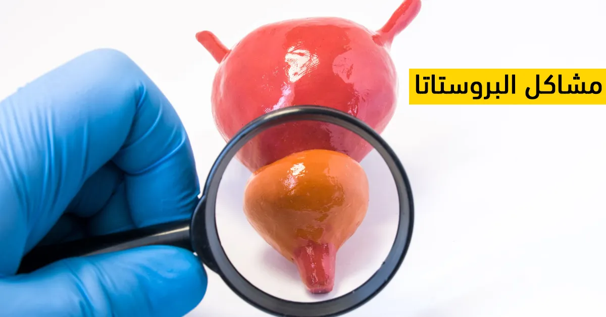 مشاكل البروستاتا